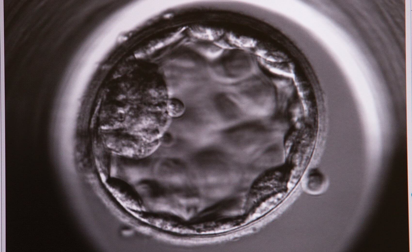 A five-day-old embryo, or blastocyst, contains two types of cells—the inner cell mass, which will develop into the fetus, and the trophectoderm cells, which will develop into the placenta.