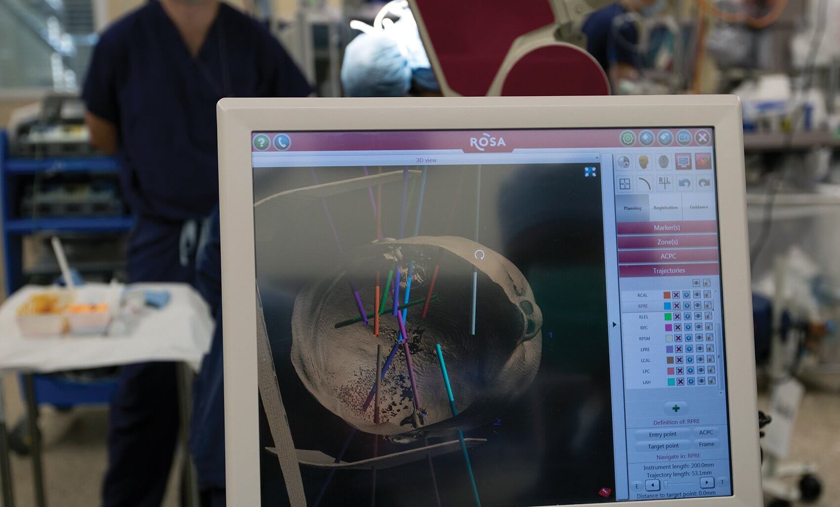 The ROSA robotic device enables
Nitin Tandon, M.D., to pinpoint where he will implant electrodes into a patient’s head to figure out where epileptic seizures originate.