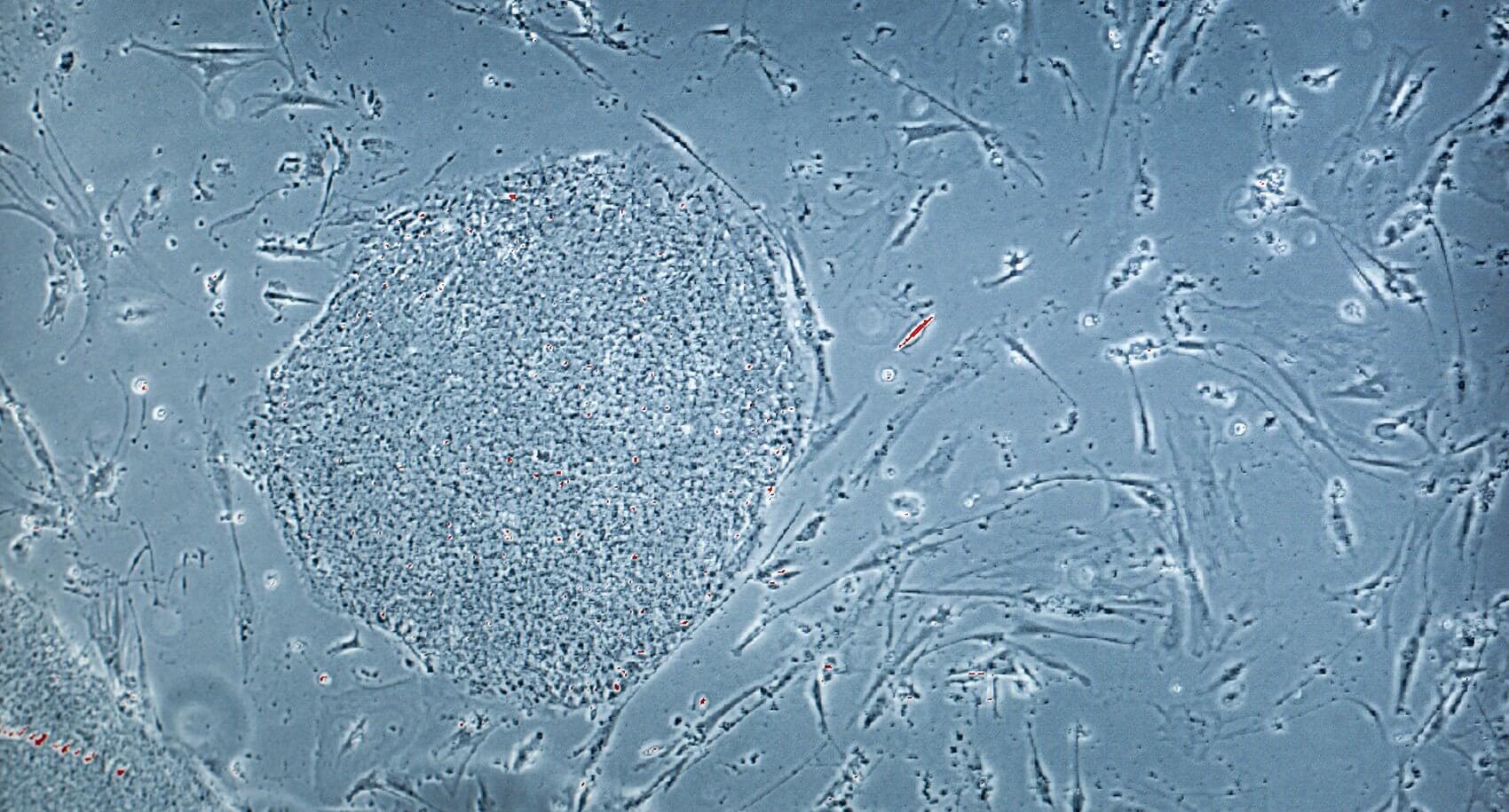Induced pluripotent stem cells (iPSCs) from a healthy patient.