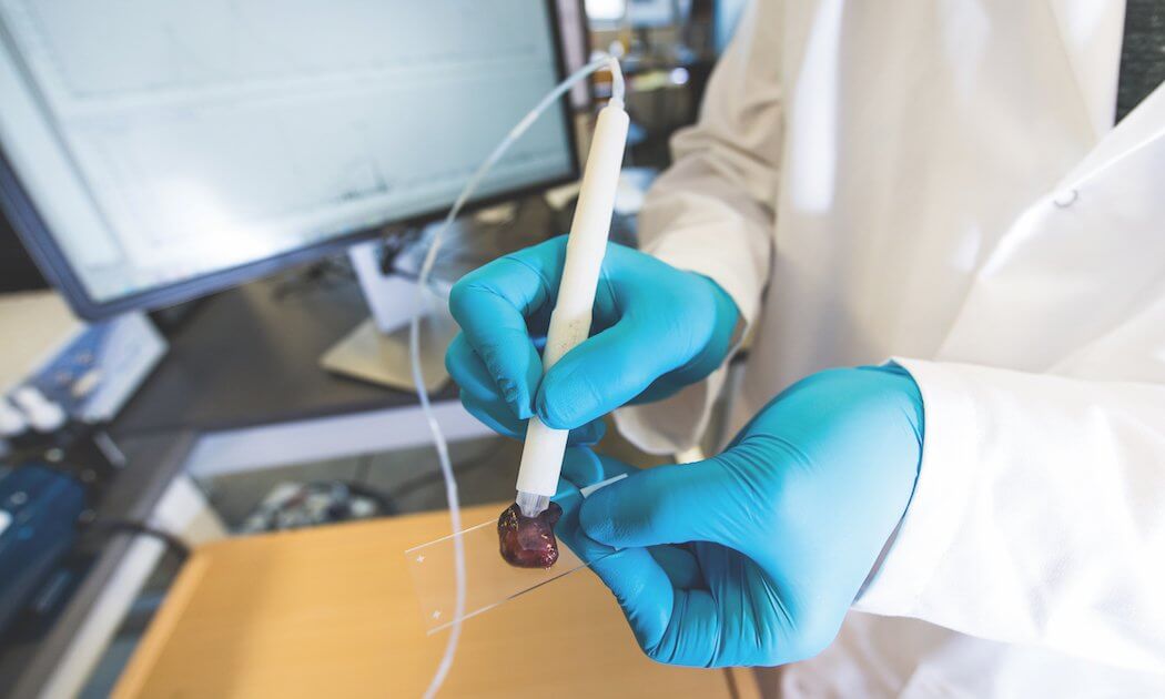 The MasSpec Pen can detect cancer in human tissue.