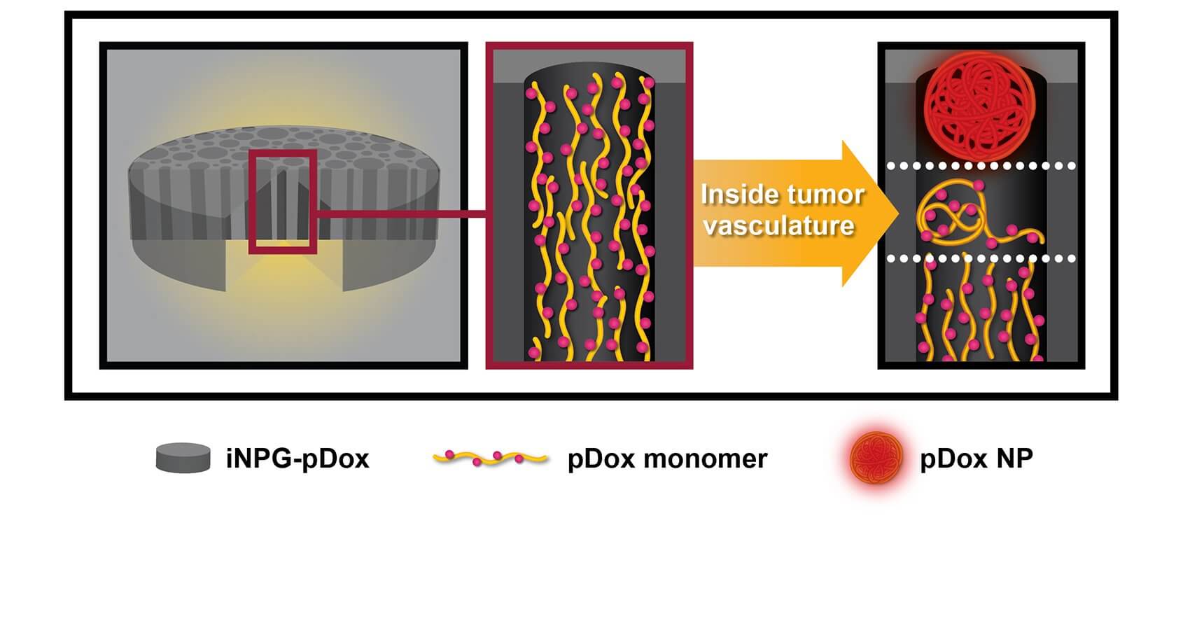 Silicon particles act as nanoparticle generators (iNPG) that carry string-like polymers loaded with a chemotherapy drug called doxorubicin (p-Dox) inside the nanopores. As the silicon particles dissolve in the tumor blood vessel, polymer molecules form tiny nanoparticles and are released.