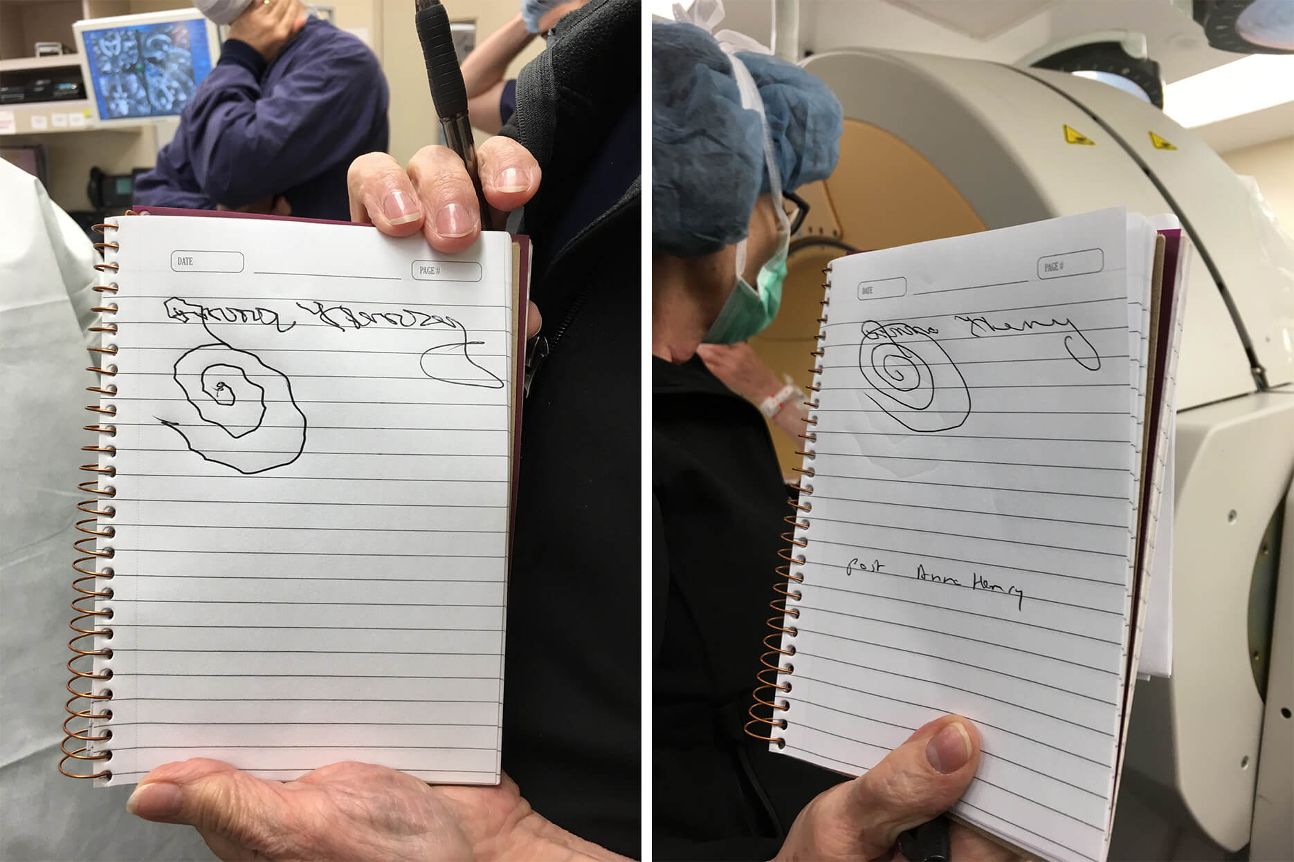 Before and after: Henry's handwriting test before the deep brain stimulation (left). Henry's handwriting test after the deep brain stimulation (right).