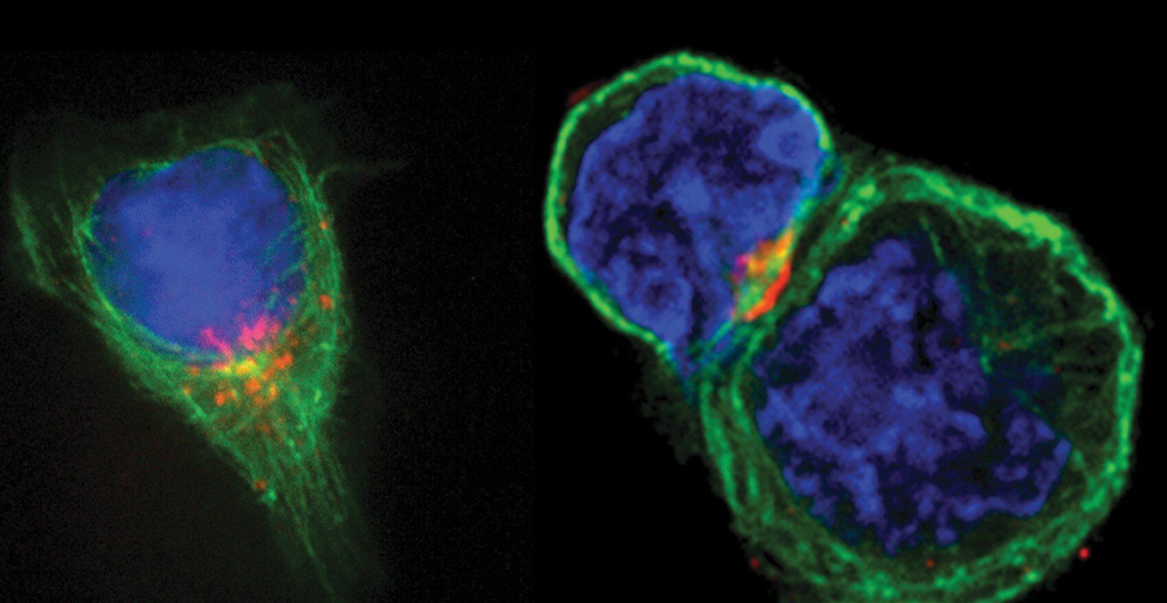 This image shows a T-cell, and to the right is a T-cell connected to an antigen-presenting cell. (Credit: MD Anderson)