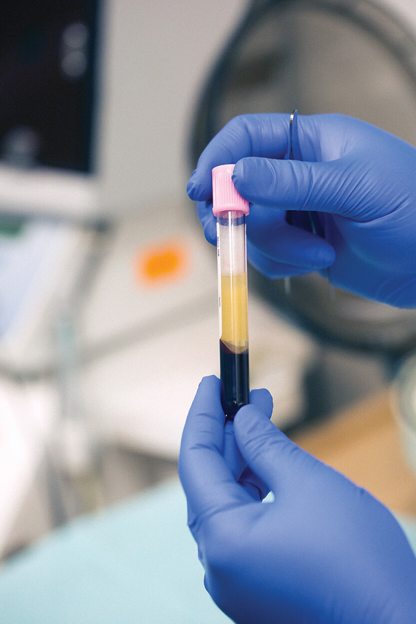 Step 3: The centrifuge separates the platelet rich plasma (PRP) from other components of the blood.