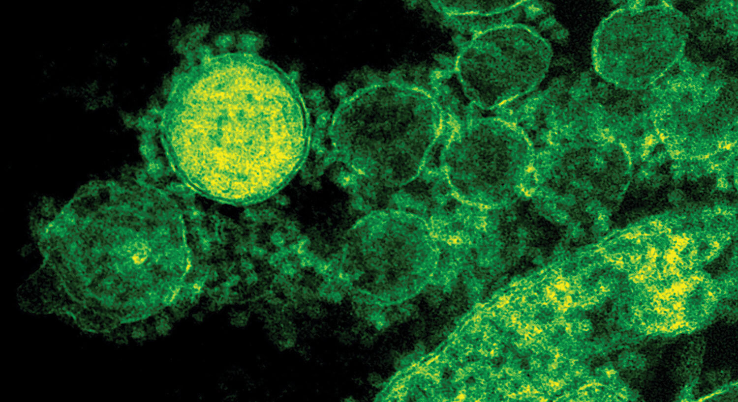 Detail from a MERS (Middle East Respiratory Syndrome) virus.